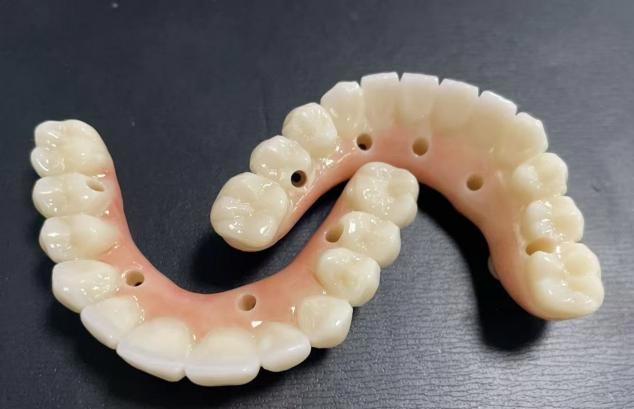 Which is Better: Removable Dentures or Fixed Dentures?