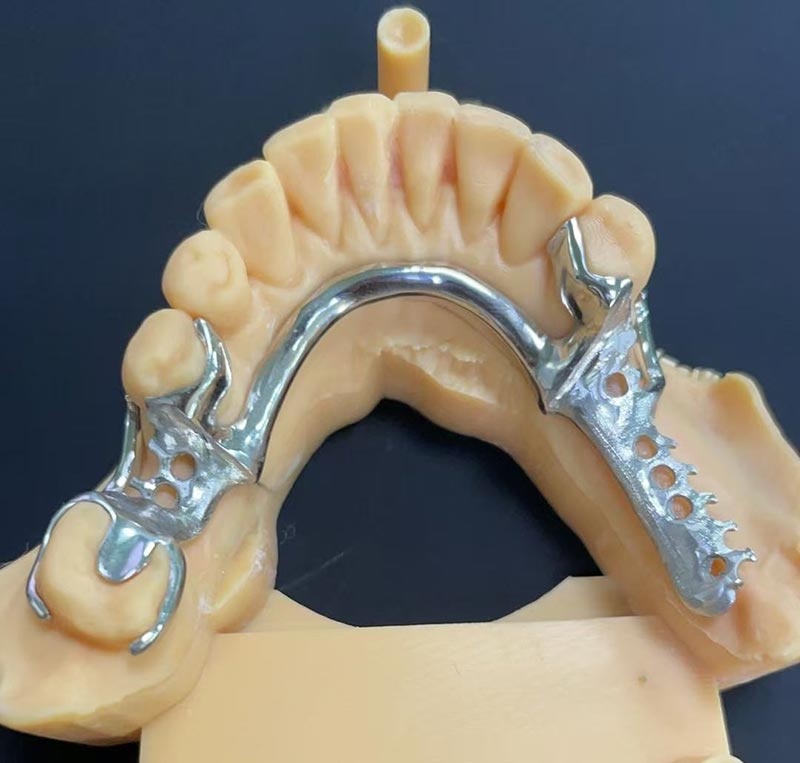 Advantages of Cobalt-Chromium Framework (Co Cr Framework)