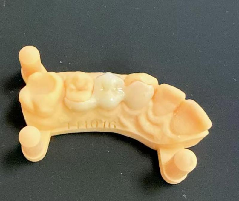 What You Need to Know About Maryland Bridges?