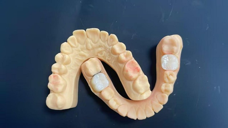 What is the shoulder edge?