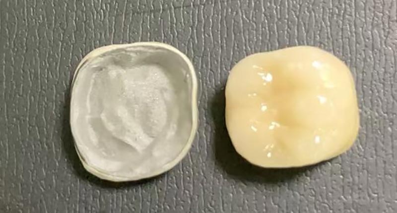 WM DENTAL LAB – A Leading Chinese Dental Lab