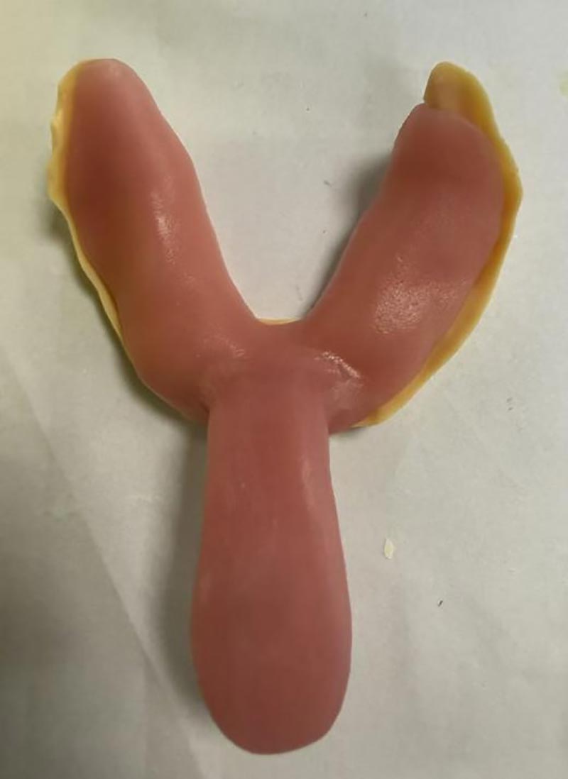 Things You Didn't Know About Custom Dental Trays