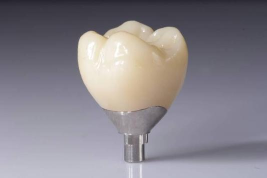 Optimize Your Outcomes with Zirconia Restorations (Crowns, Bridges, Implants)
