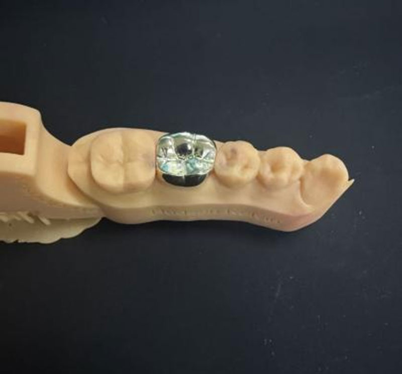 Gold Teeth VS NPG Teeth