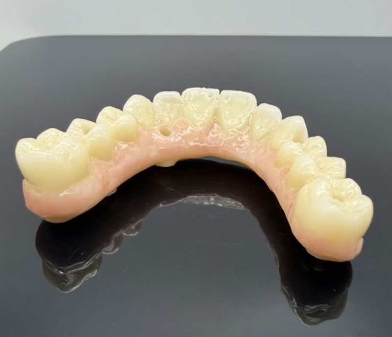 Common Materials for Dental Crowns and Bridges