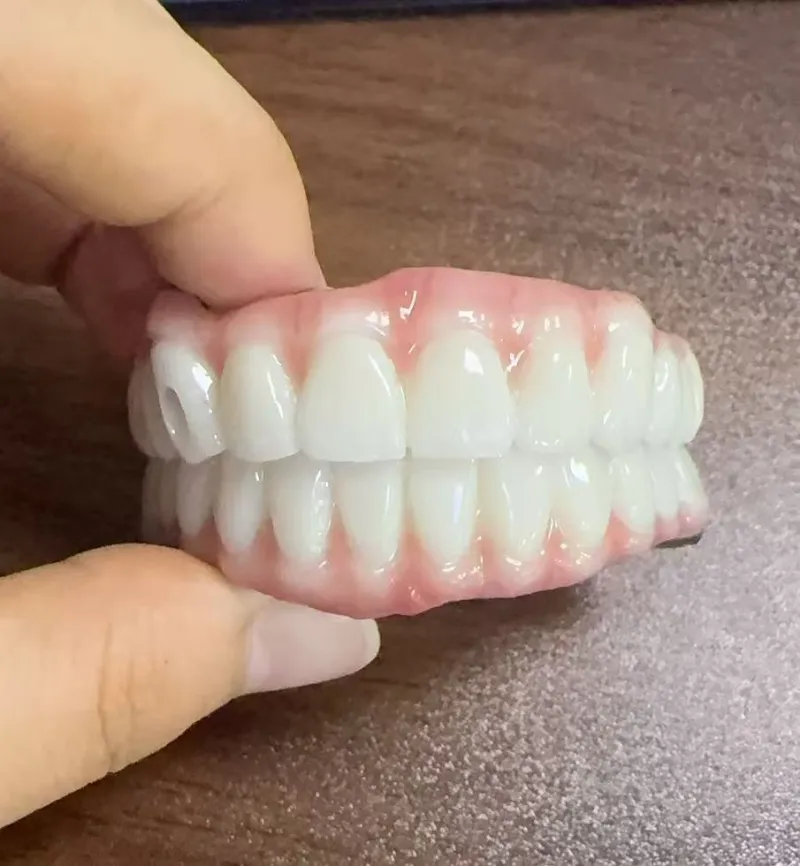 Hazards of Malocclusion
