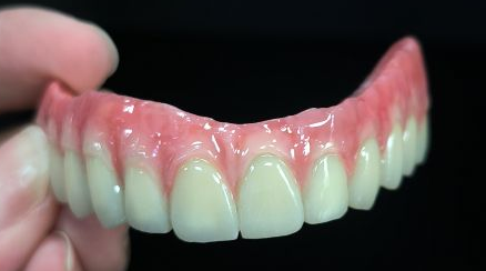 All on 4 hybrid -  Malo Bridge Full Zirconia Crowns Over titanium Structure