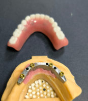 Locator and dental bar